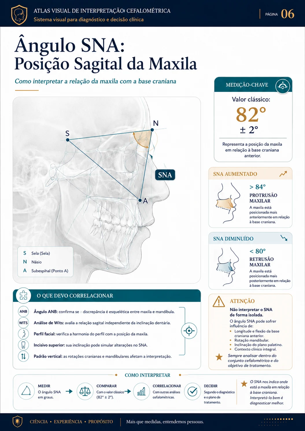 Ângulo SNA: Posição Sagital da Maxila